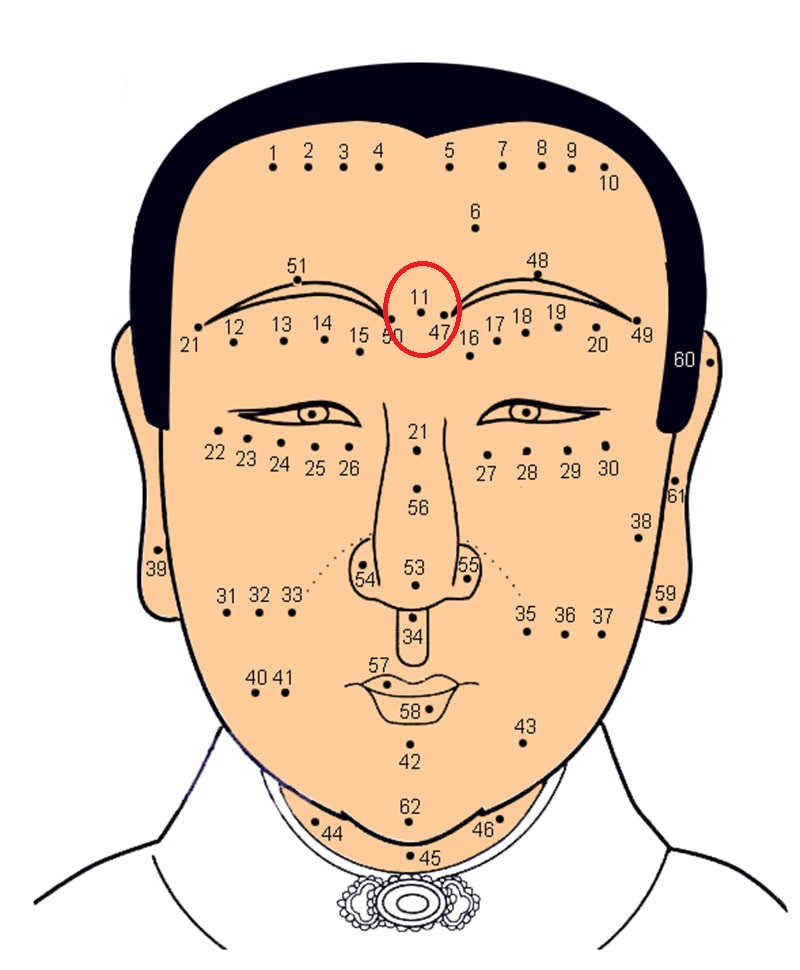 Có nốt ruồi trên trán: Không sớm thì muộn cũng gặp “chuyện’’?