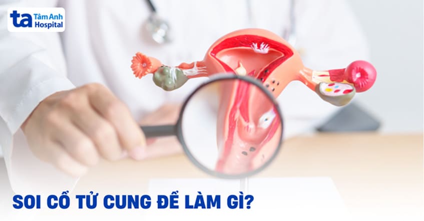 Soi cổ tử cung là gì? Soi để làm gì? Có ảnh hưởng gì không?